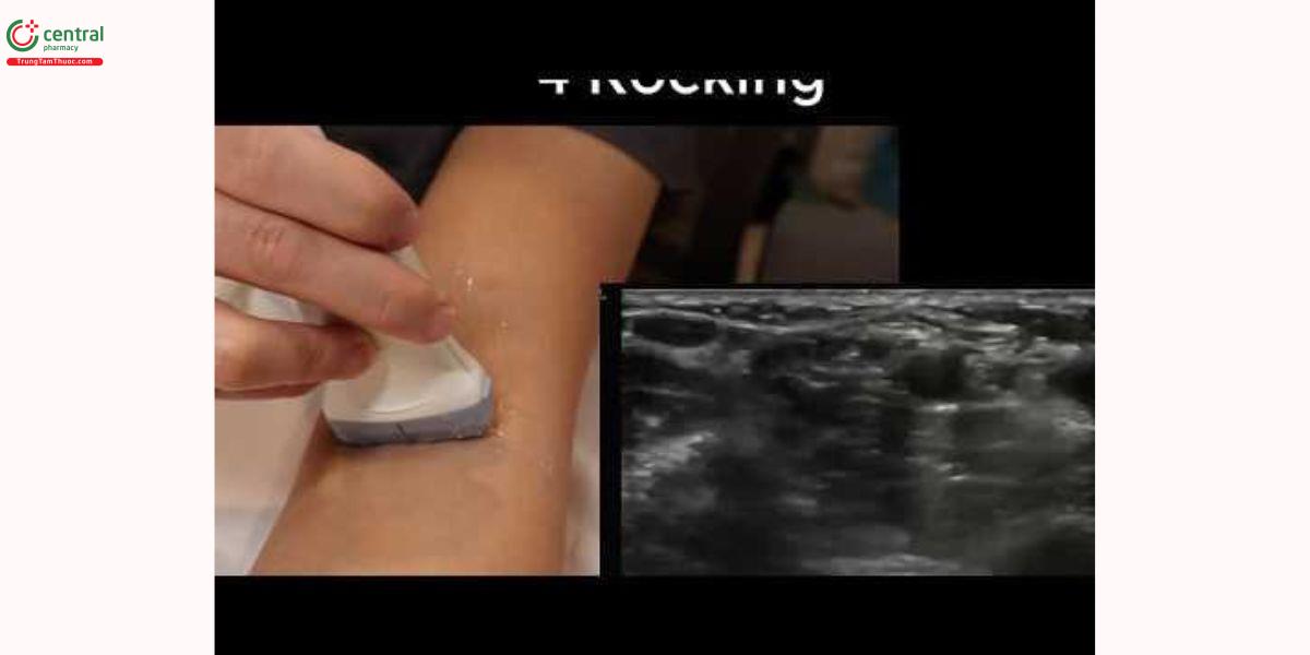Thao tác sử dụng đầu dò siêu âm
