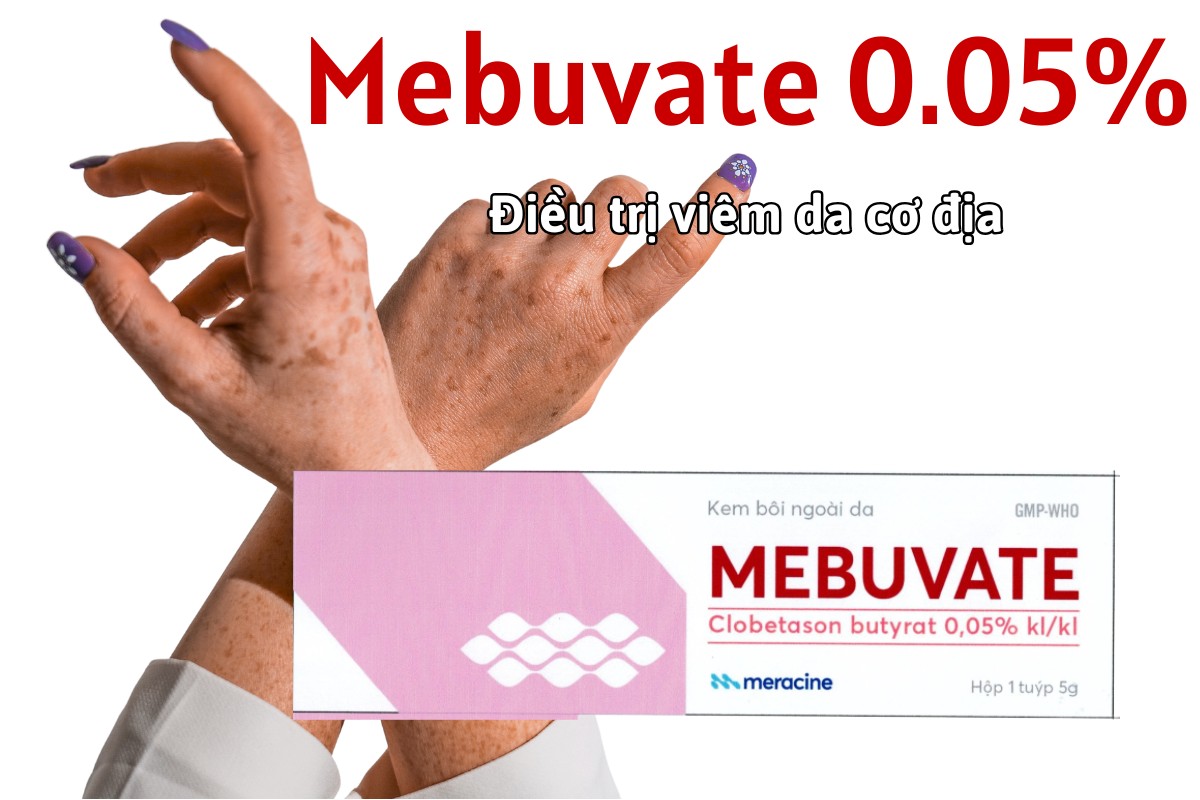 Thuốc Mebuvate 0.05% điều trị viêm da cơ địa (bệnh chàm), viêm da tiếp xúc
