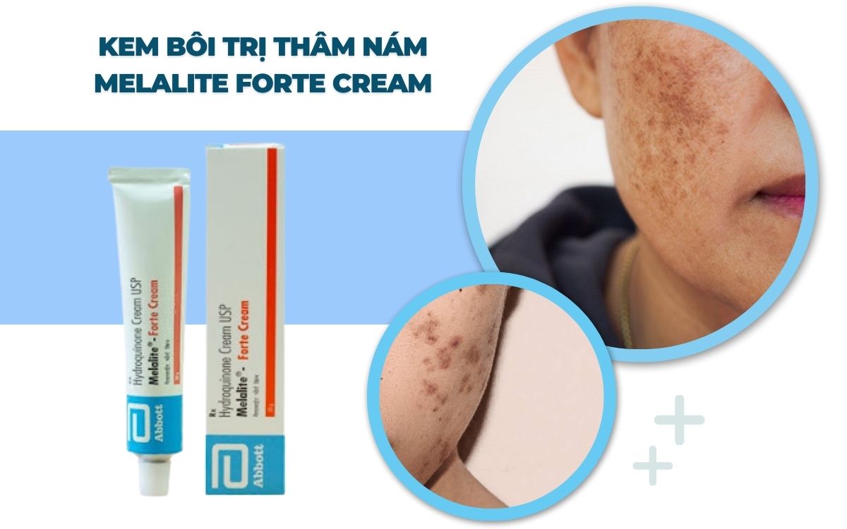 Kem bôi Melalite Forte Cream