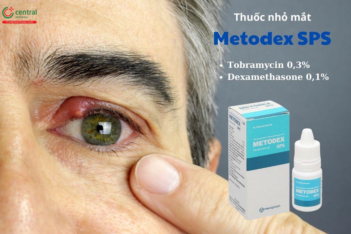 Thuốc nhỏ mắt Metodex SPS 7ml