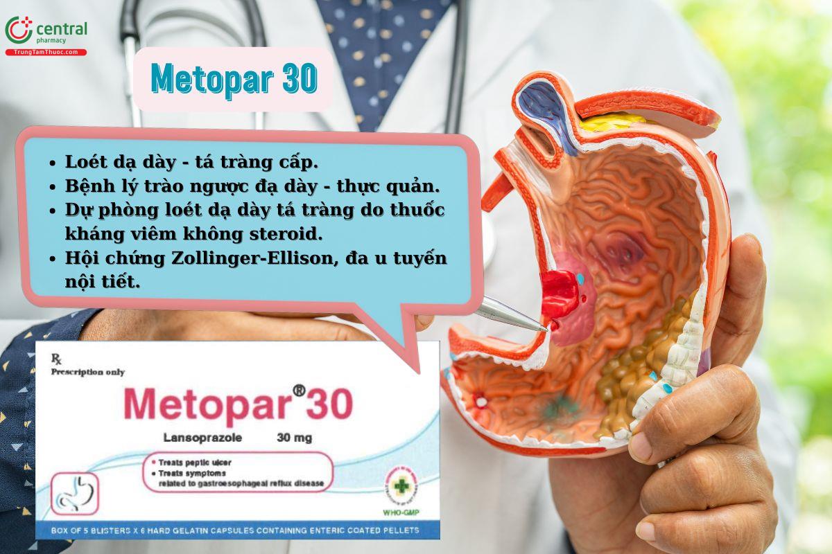 Thuốc Metopar 30 điều trị loét dạ dày tá tràng, chứng tăng acid bệnh lý
