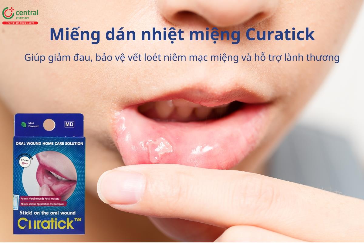 Miếng dán nhiệt miệng Curatick giúp bảo vệ vết loét miệng, giảm đau rát