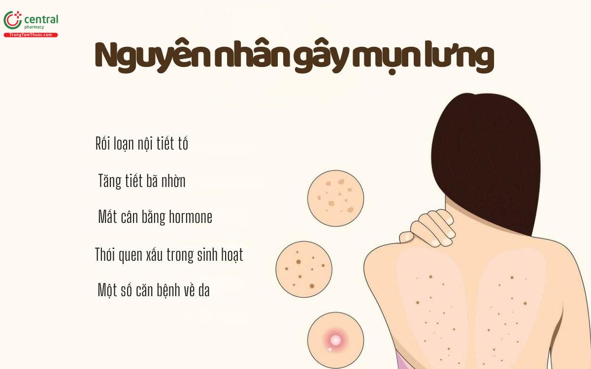 Nguyên nhân mụn lưng là gì?