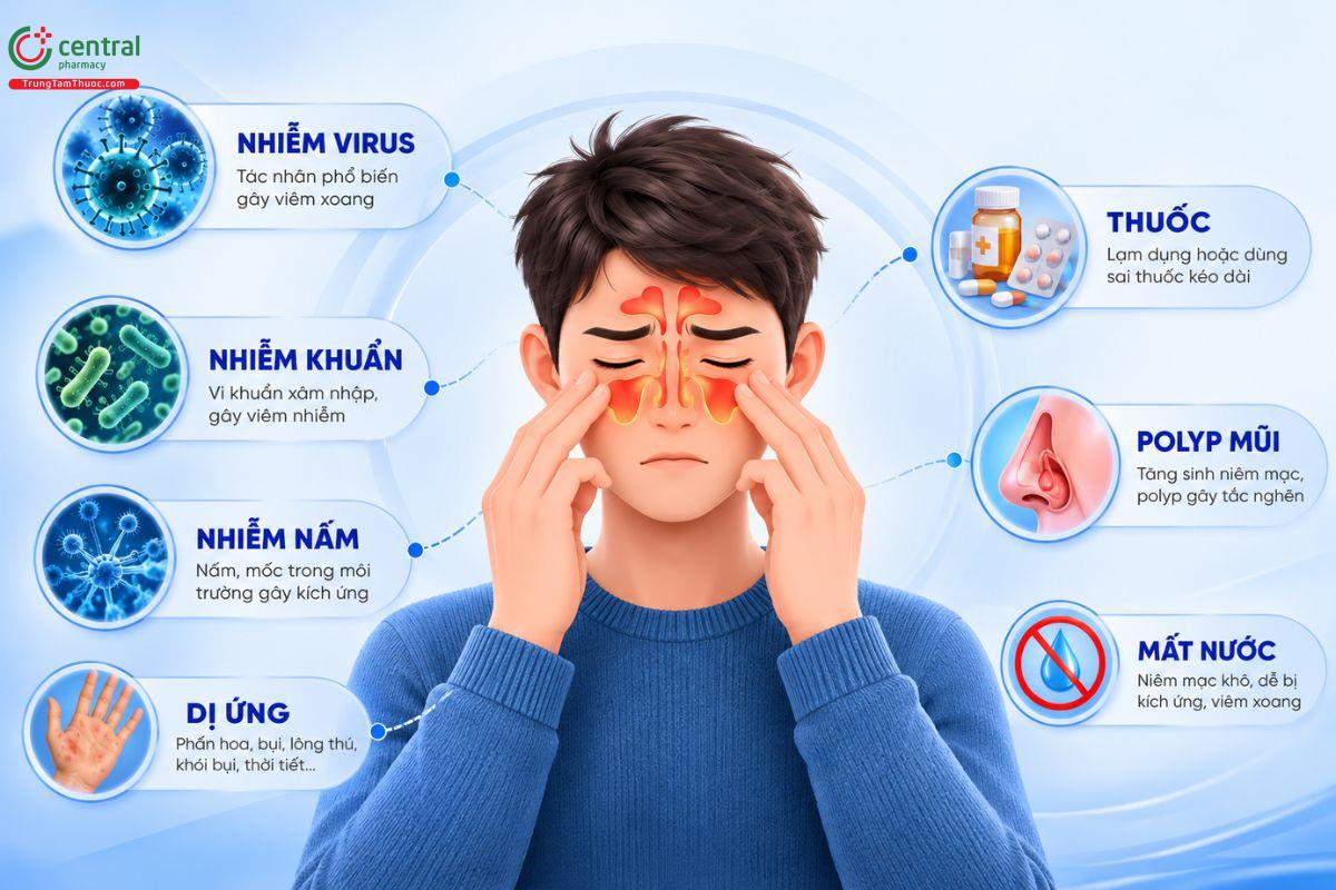 Các nguyên nhân gây nên viêm xoang