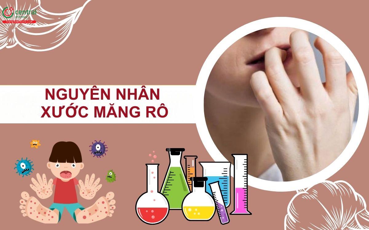 Nguyên nhân bị xước măng rô ngón tay