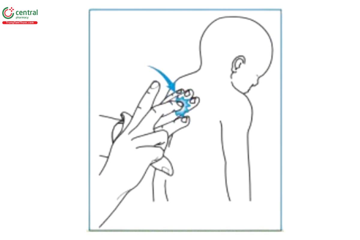 Hình 1.2 Kỹ thuật gõ gián tiếp để đánh giá cấu trúc bên dướii