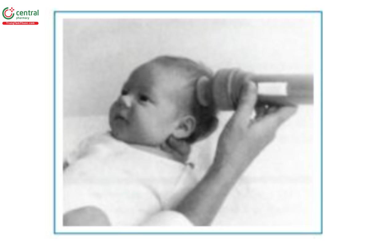 Hình 1.3 Chiếu ánh sáng xuyên (Transillumination)