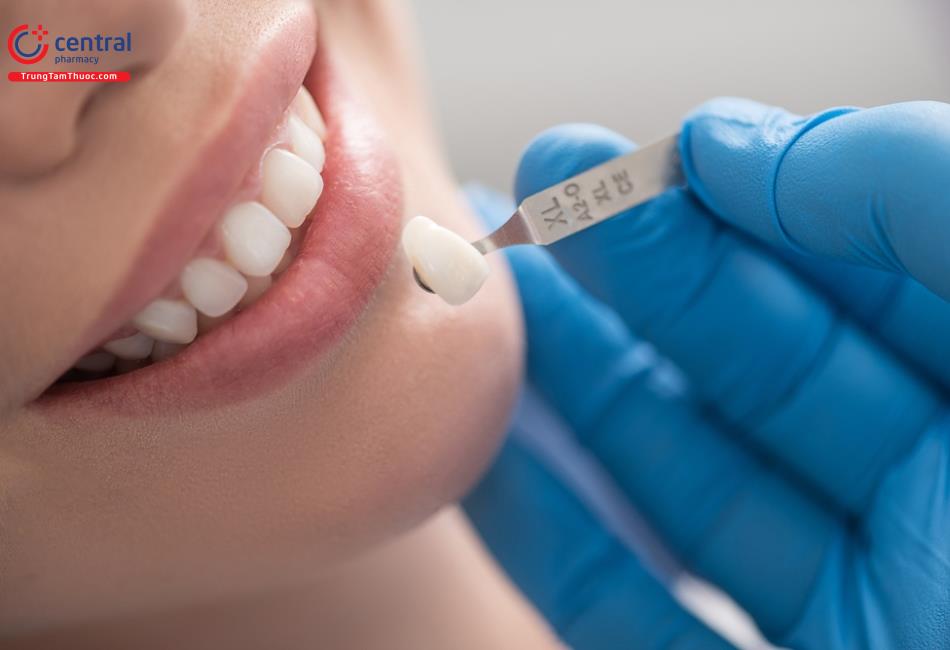 Kỹ thuật của nha sĩ không tốt có thể khiến răng sứ bị lệch