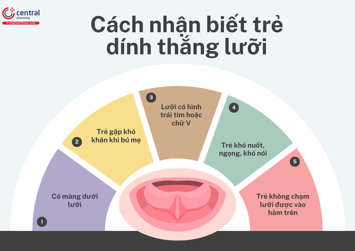 Cách nhận biết trẻ dính thắng lưỡi