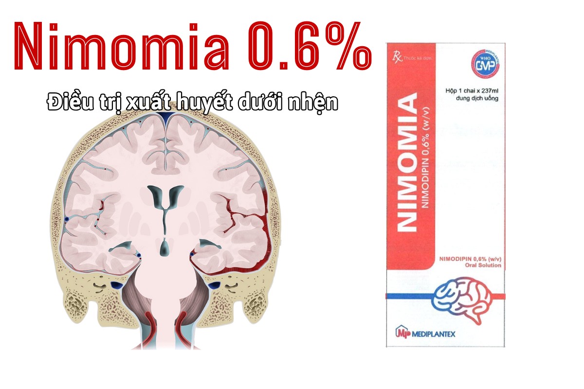 Thuốc Nimomia 0.6% điều trị xuất huyết dưới nhện do vỡ phình mạch não