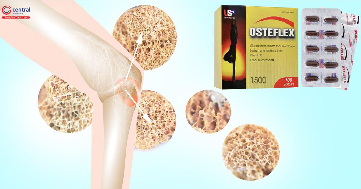 Osteflex 1500mg giúp bảo vệ xương khớp