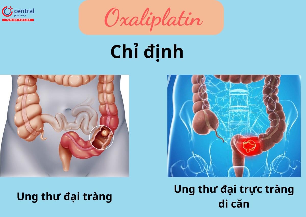 Chỉ định của Oxaliplatin