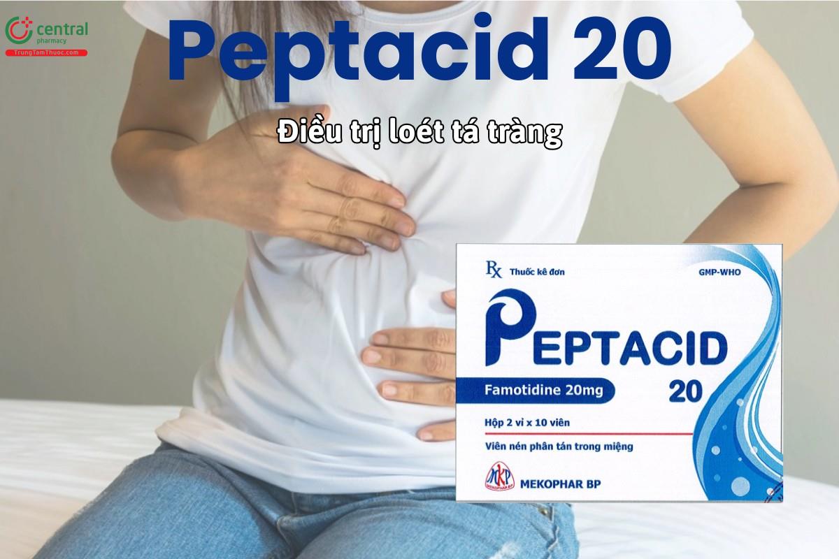 Thuốc Peptacid 20 điều trị loét tá tràng và trào ngược dạ dày thực quản
