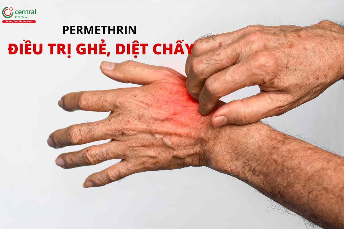 Chỉ định của permethrin