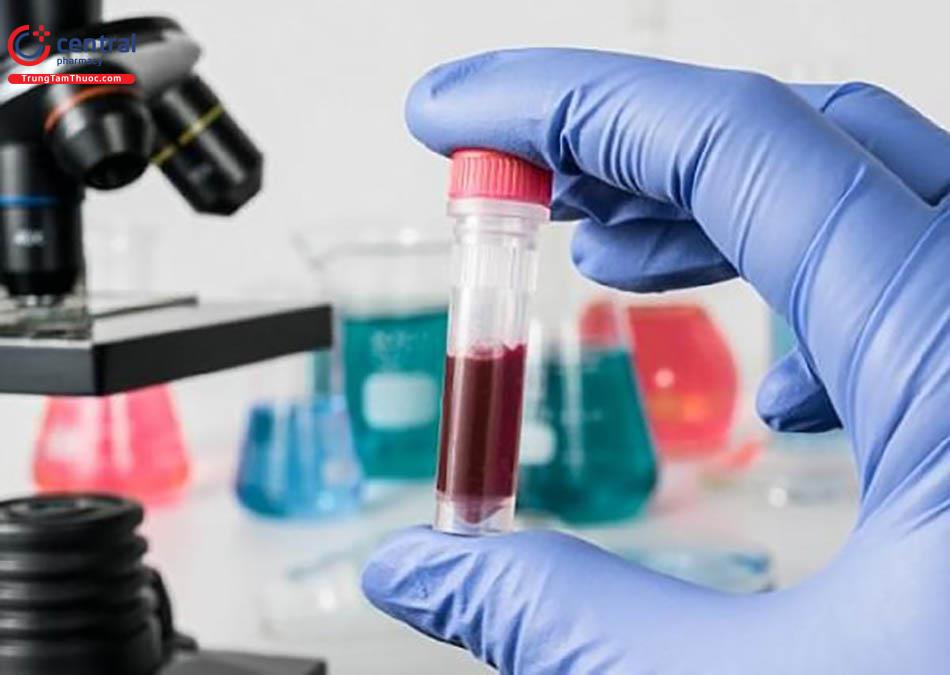 Tổng phân tích tế bào máu chẩn đoán sản giật