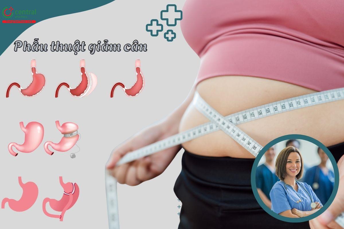 Đánh giá phẫu thuật giảm cân