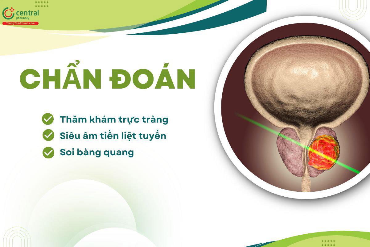 Chẩn đoán bệnh tăng sinh lành tính tuyến tiền liệt
