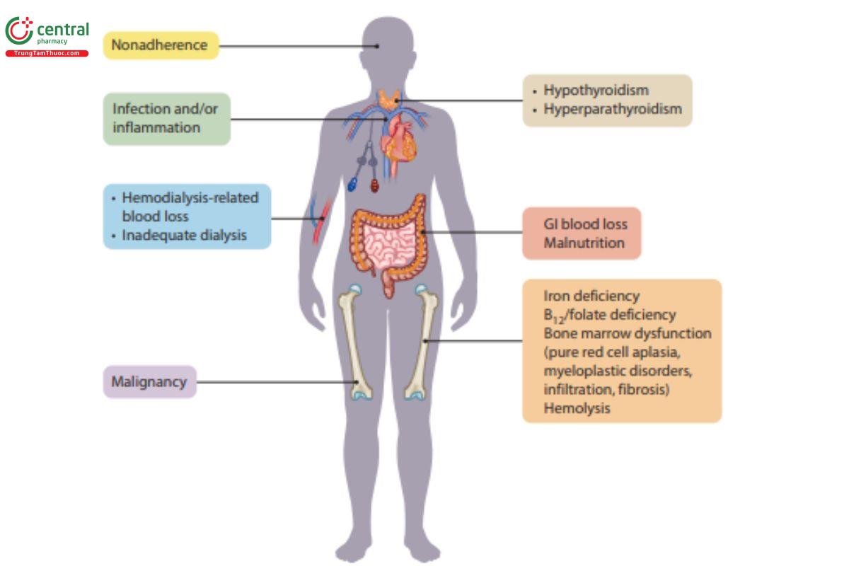Ngoài việc giảm sản xuất erythropoietin, các nguyên nhân có thể đảo ngược gây thiếu máu ở bệnh nhân suy thận mãn tính cũng bao gồm giảm sản xuất erythropoietin.