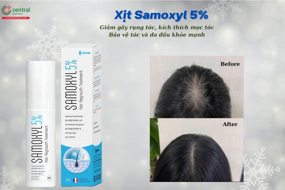 Dung dịch xịt tóc Samoxyl 5% giúp giảm gãy rụng, kích thích mọc tóc