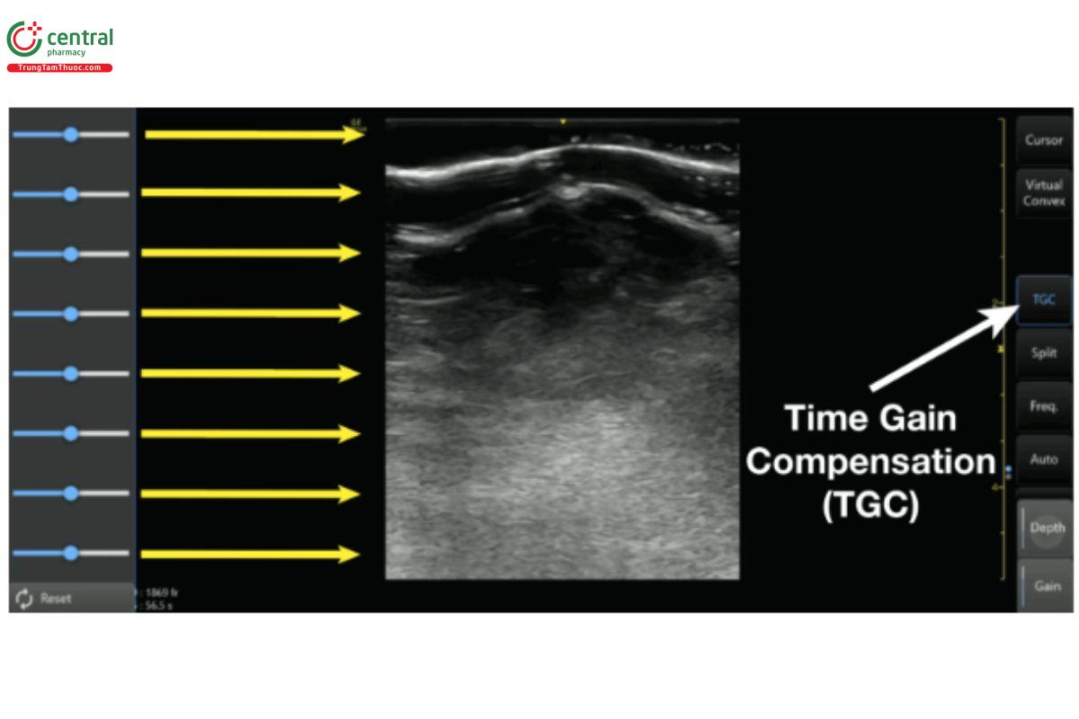 Time Gain Compensation (TGC).