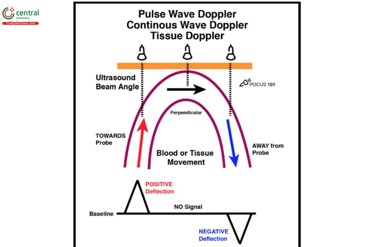 Minh họa nguyên lý của các mode Doppler.