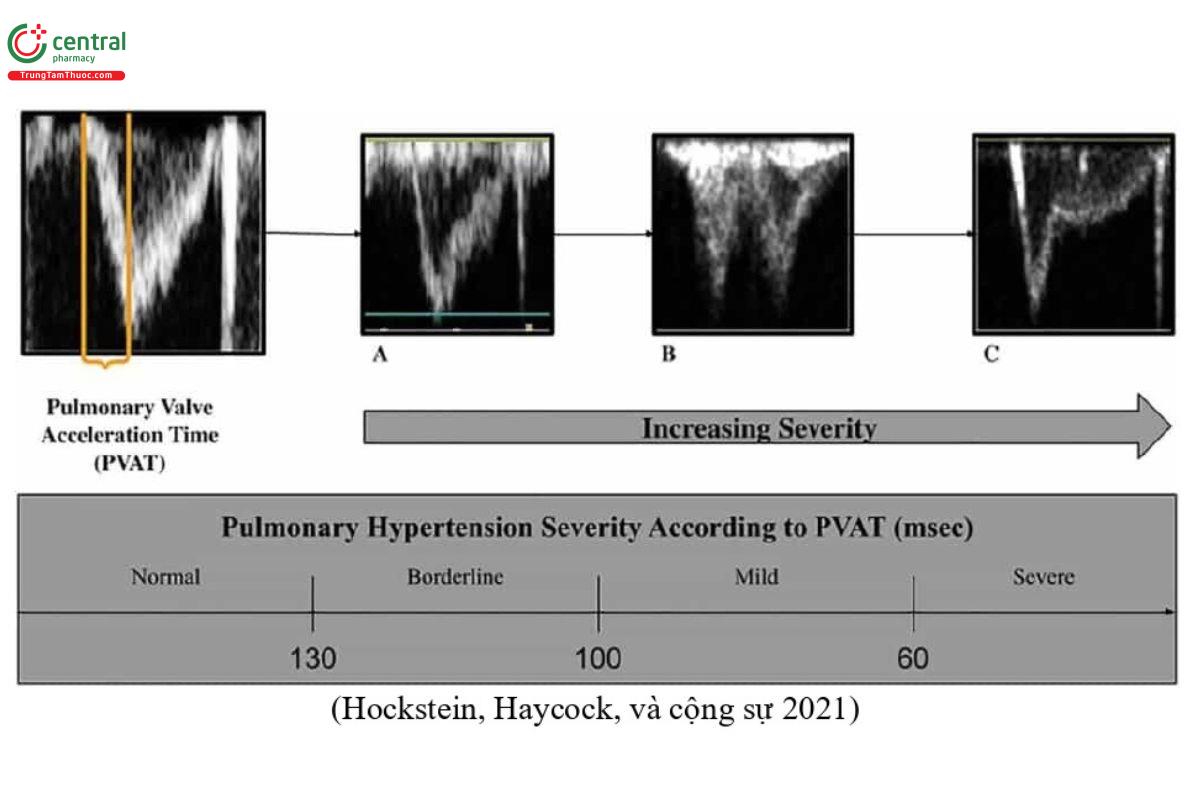 (Hockstein, Haycock, và cộng sự 2021)