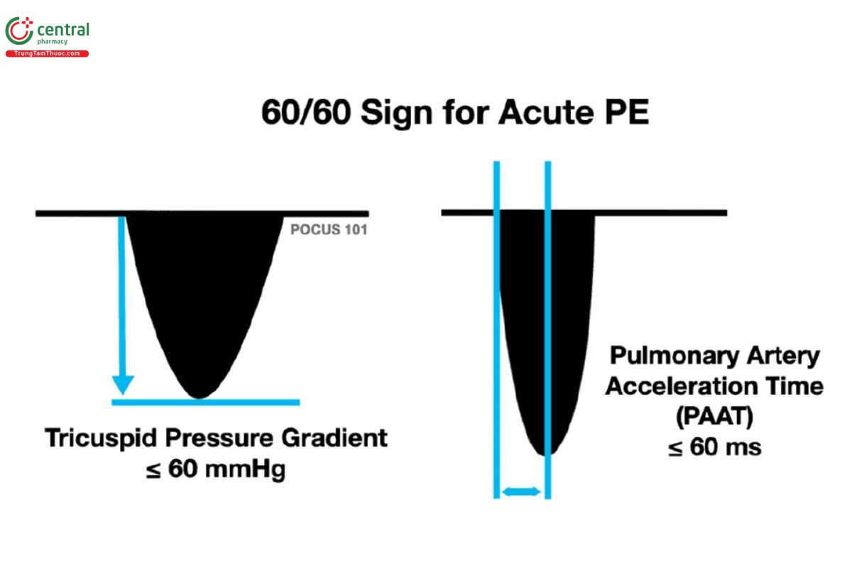Dấu 60/60 sign