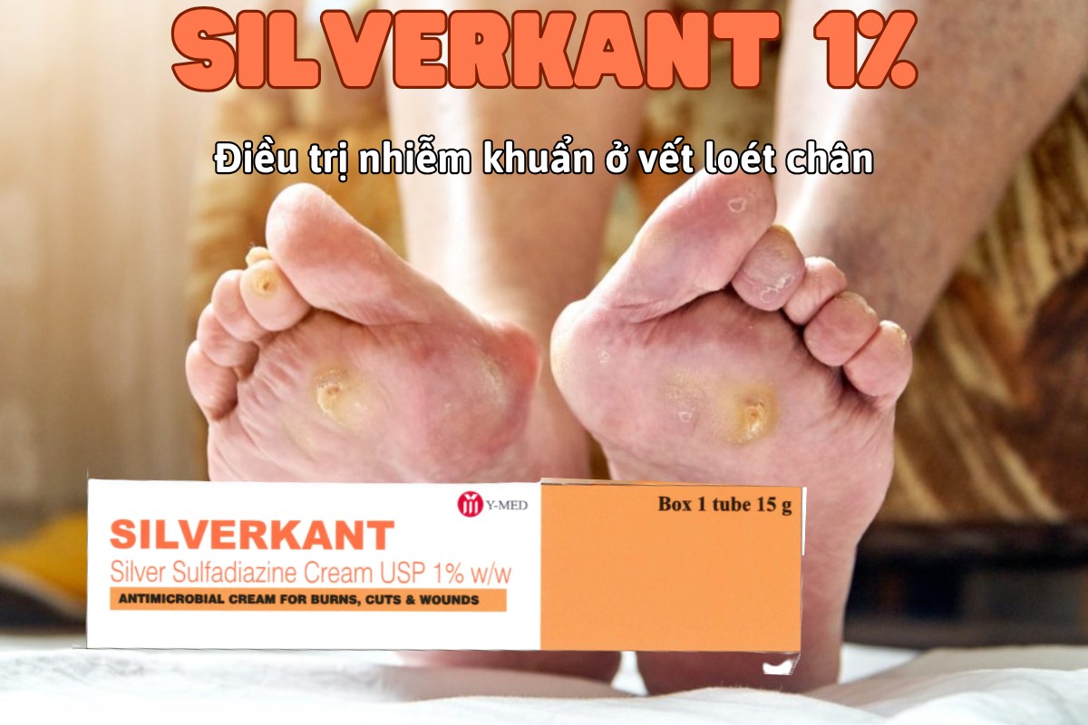 Thuốc Silverkant 1% điều trị nhiễm khuẩn tại chỗ ở vết loét chân, vết bỏng