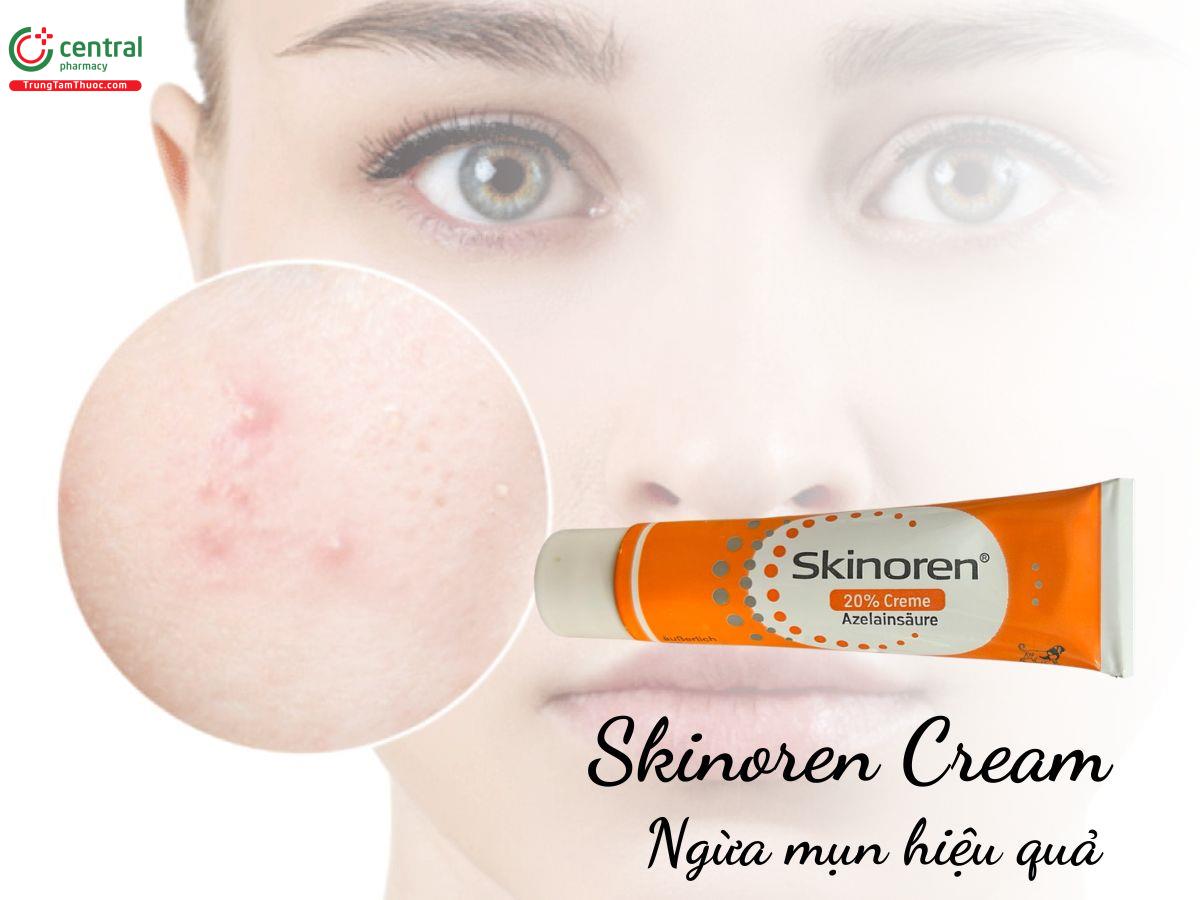 Skinoren Cream - Ngừa mụn hiệu quả