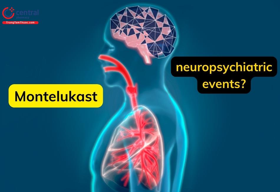 Nguy cơ gặp các biến cố thần kinh khi sử dụng Montelukast là khá hiếm gặp