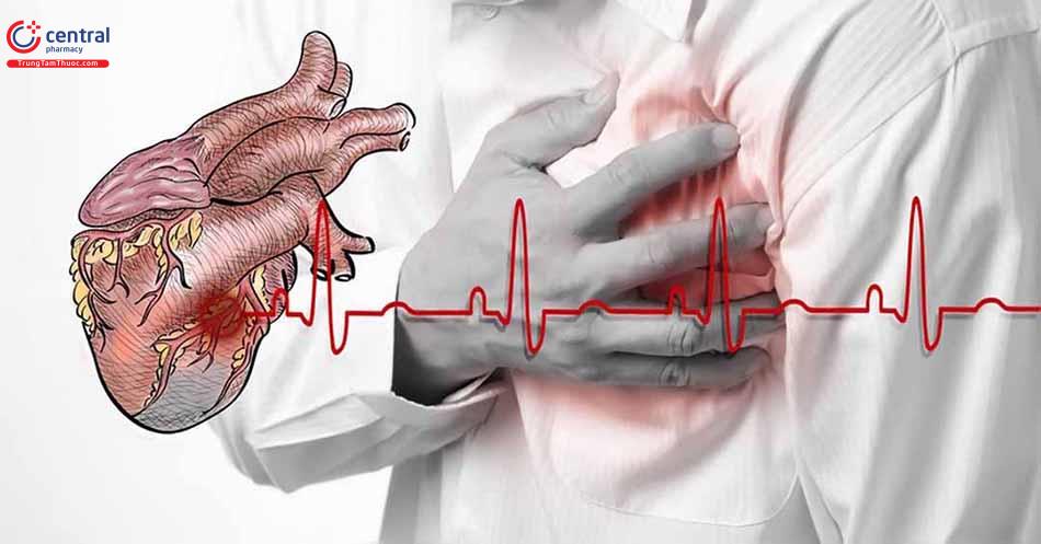 Hình ảnh thể hiện bệnh suy tim