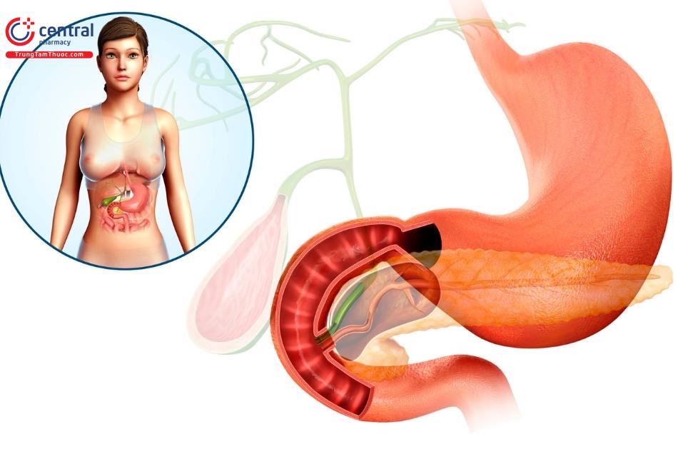 Tá tràng là đoạn đầu tiên của ruột non