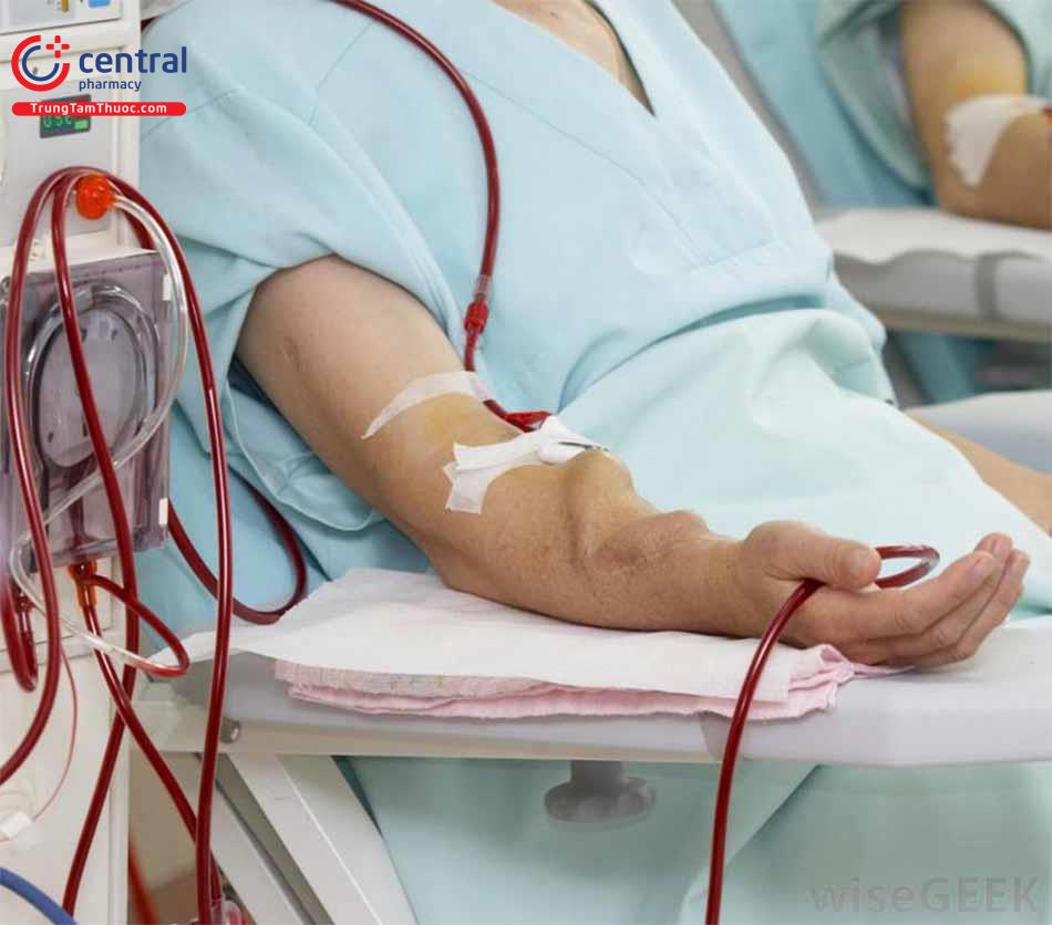 Lọc máu nếu cần để điều trị tăng canxi máu