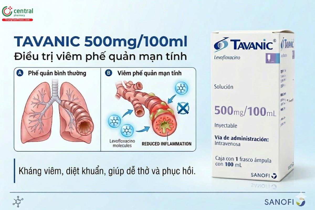 Thuốc Tavanic 500mg/100ml điều trị viêm phế quản mạn tính