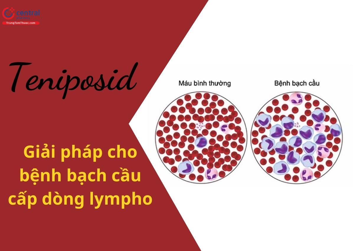 Teniposid điều trị bệnh bạch cầu dòng lympho
