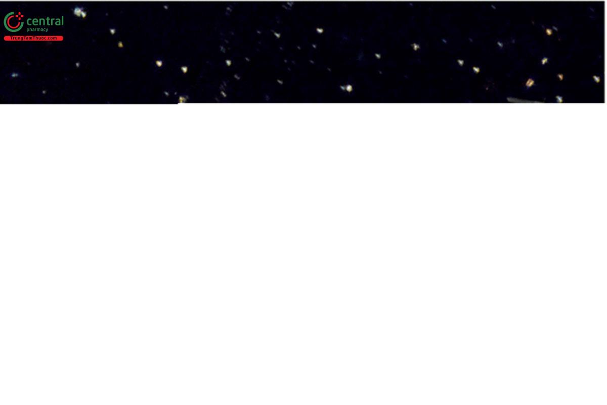 Figure 11. Tremolite (blue) compared to talc particles (pale blue) in 1.620 RI liquid (blue particle is oriented perpendicular to the lower polarizer). Spiked material was retained on a 400-mesh sieve.