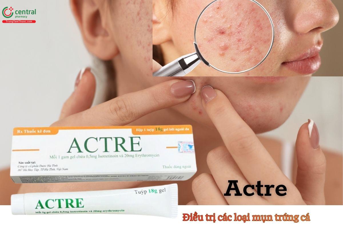 Thuốc Actre điều trị mụn trứng cá