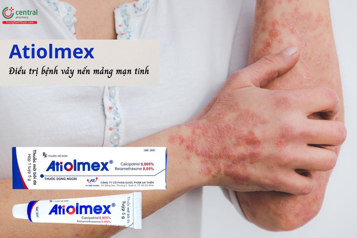 Thuốc Atiolmex - Điều trị bước đầu bệnh vảy nến mảng mạn tính