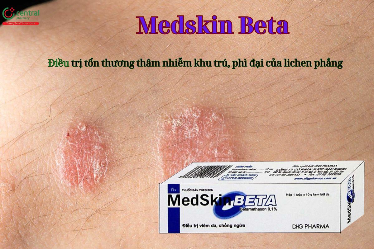 Thuốc Medskin Beta điều trị viêm da, chống ngứa