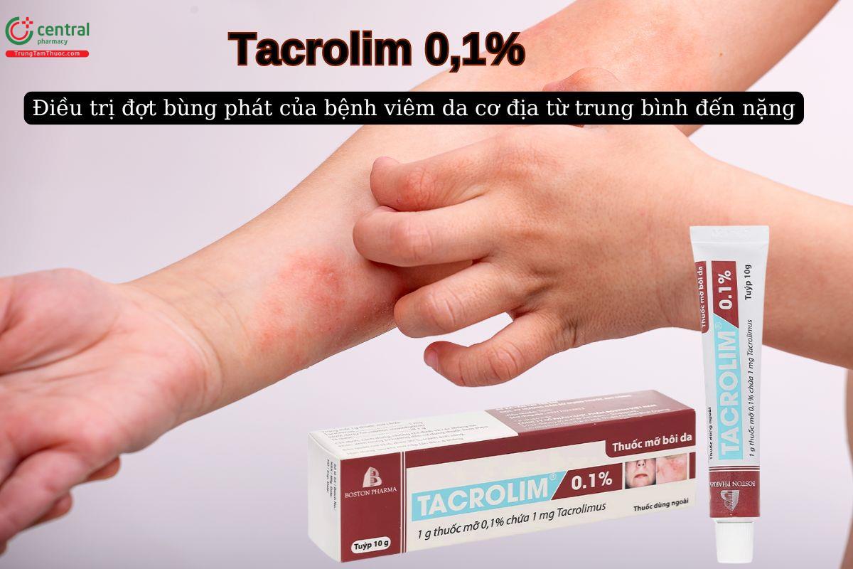 Thuốc Tacrolim 0,1% Boston điều trị viêm da dị ứng từ trung bình đến nặng