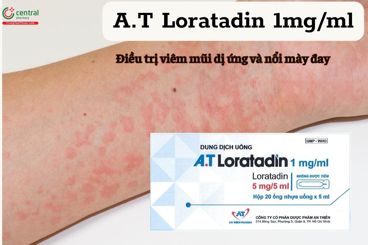 Thuốc A.T Loratadin 1mg/ml trị bệnh gì?