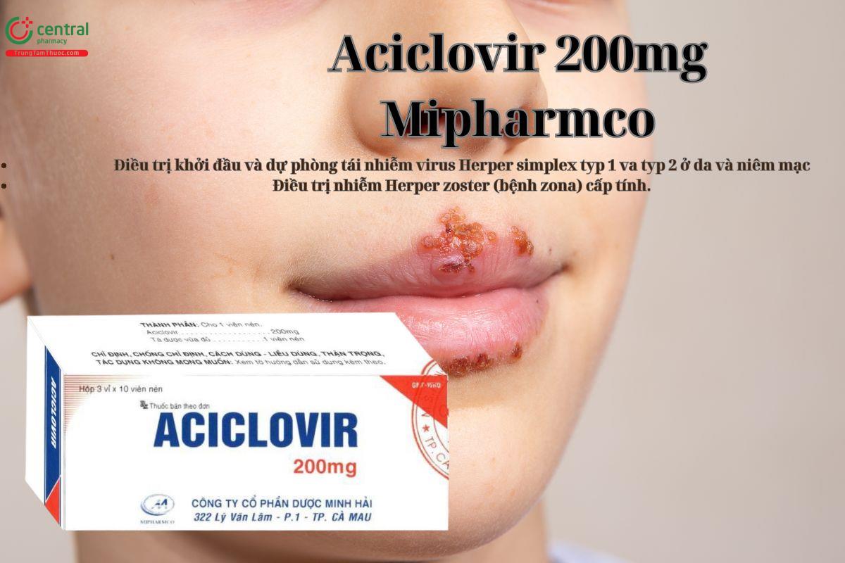 Thuốc Aciclovir 200mg Mipharmco điều trị bệnh Zona