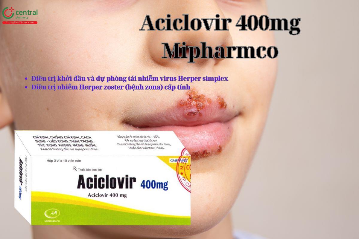 Thuốc Aciclovir 400mg Mipharmco điều trị bệnh Zona