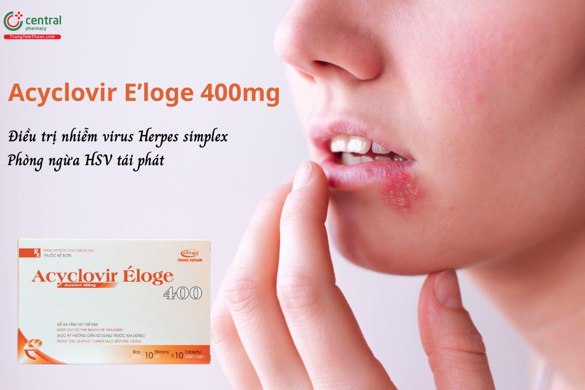 Thuốc Acyclovir E’loge 400mg - Điều trị nhiễm virus Herpes simplex lần đầu và tái phát