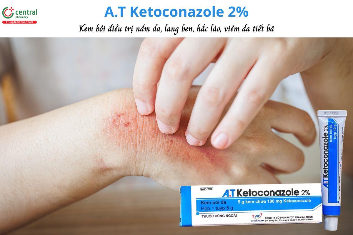 Thuốc A.T Ketoconazole 2% - Điều trị nấm thân (lác, hắc lào), lang ben