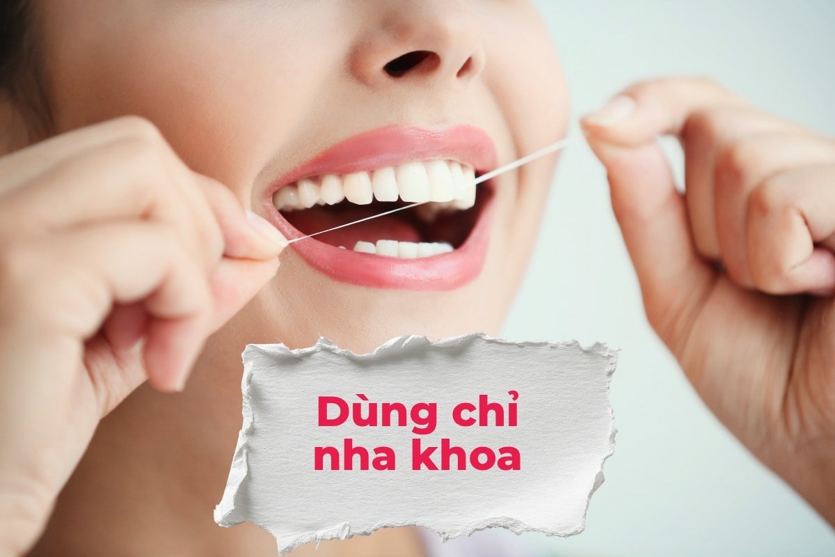 Nên sử dụng chỉ nha khoa để vệ sinh răng miệng