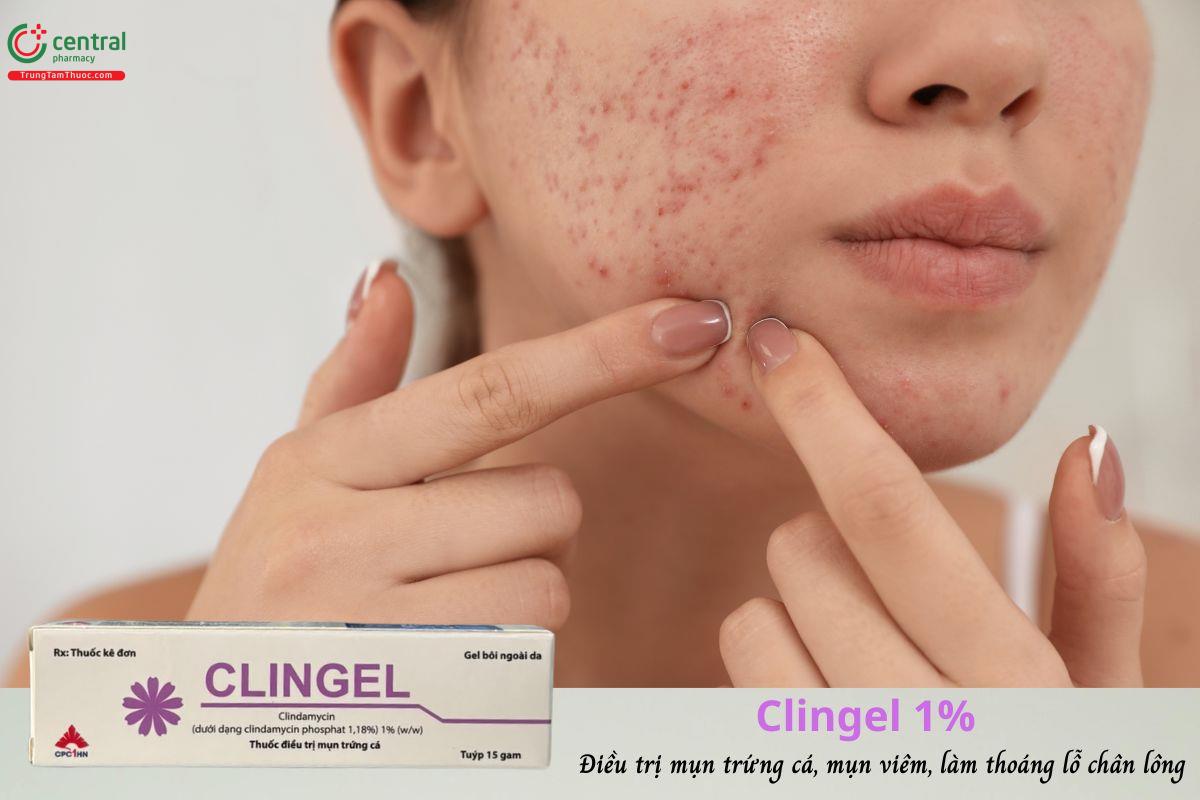 Thuốc Clingel 1% dạng gel điều trị mụn trứng cá, mụn viêm