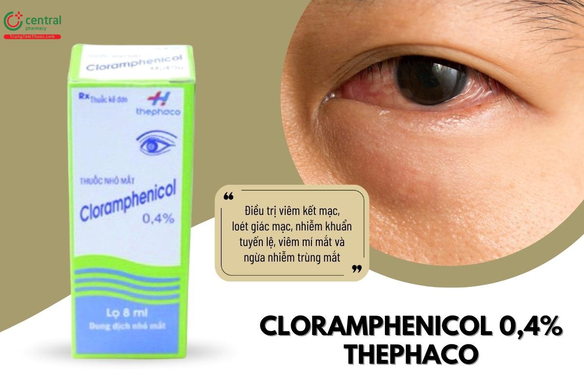 Chỉ định của thuốc Cloramphenicol 0,4% Thephaco