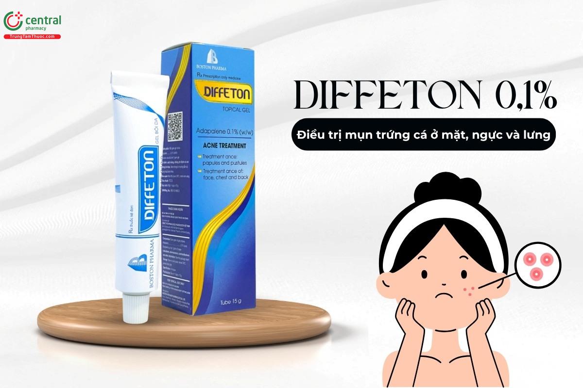 Thuốc Diffeton 0,1% điều trị mụn trứng cá