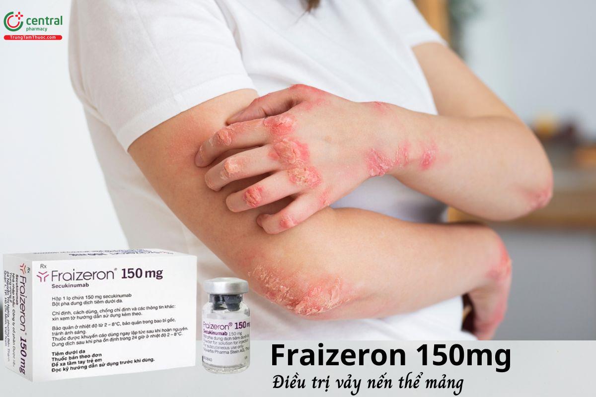 Thuốc Fraizeron 150mg - Điều trị vảy nến thể mảng mức độ trung bình đến nặng